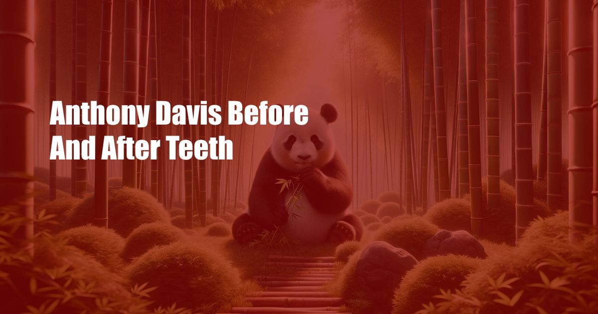 Anthony Davis Before And After Teeth