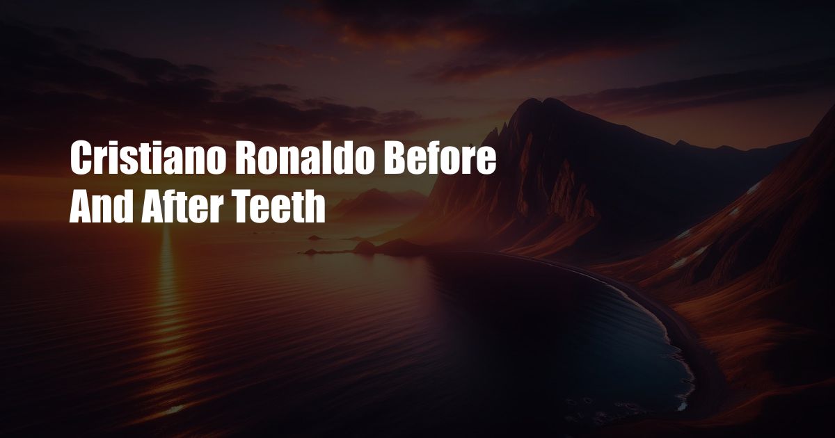 Cristiano Ronaldo Before And After Teeth