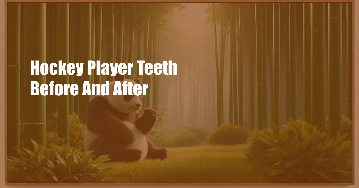 Hockey Player Teeth Before And After